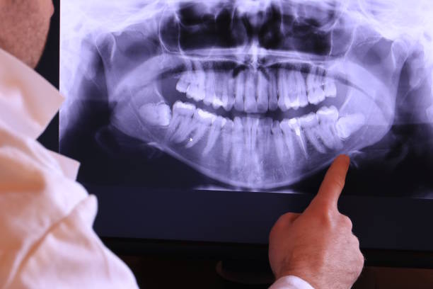 Best Emergency Dentist for Lost Fillings or Crowns in Lantana, TX
